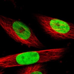 MeCP2 Antibody, Novus Biologicals 0.1mL; Unlabeled:Antibodies, Polyclonal